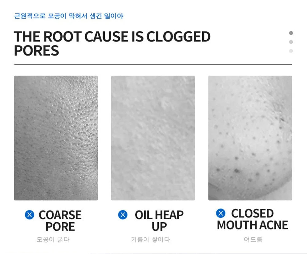 Salicylic Acid Pore-Refining Cream – Blackhead &amp; Large Pore Treatment