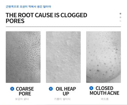 Salicylic Acid Pore-Refining Cream – Blackhead &amp; Large Pore Treatment
