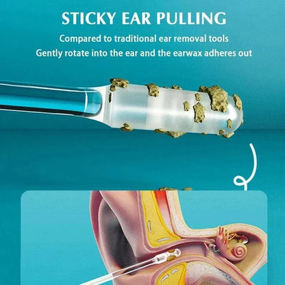 Ear Wax Cleaning Tool Set – Gentle Sticky Ear Digger Spoons