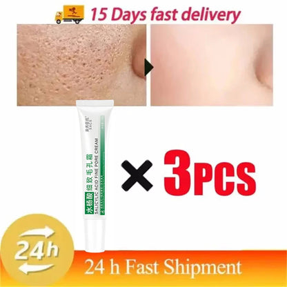 Salicylic Acid Pore-Refining Cream – Blackhead &amp; Large Pore Treatment