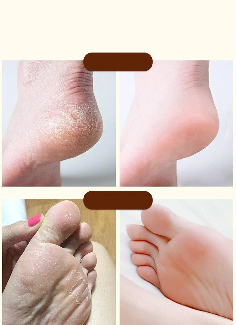 كريم مكثف مرطب للقدمين واليدين – إصلاح للبشرة الجافة والمتشققة