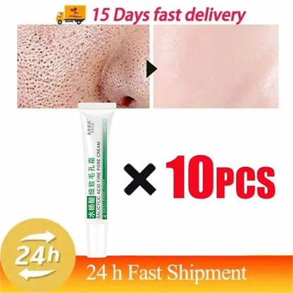 Salicylic Acid Pore-Refining Cream – Blackhead &amp; Large Pore Treatment