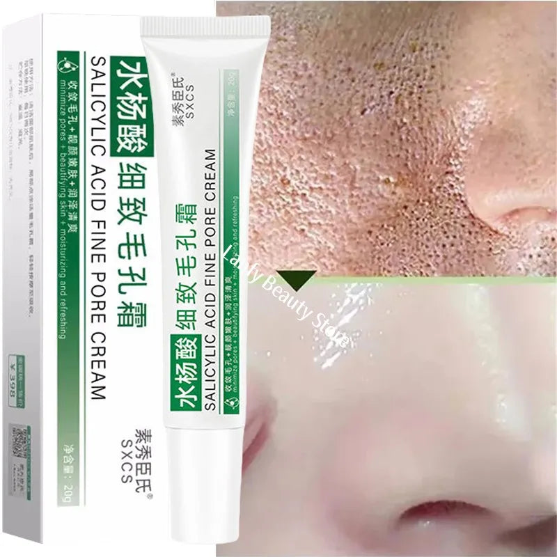 Salicylic Acid Pore-Refining Cream – Blackhead &amp; Large Pore Treatment