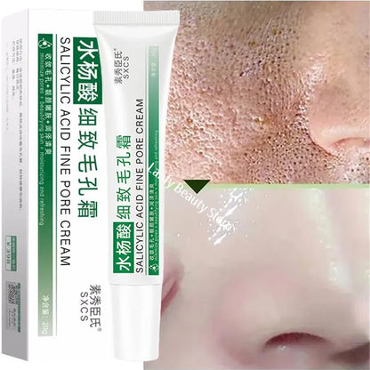 Salicylic Acid Pore-Refining Cream – Blackhead &amp; Large Pore Treatment
